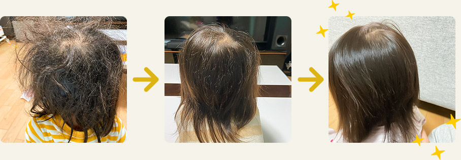 つげ櫛と椿油の髪のくせ毛への使用効果